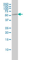1 - K-ALPHA-1 Antibody (monoclonal) (M01) AT2589a