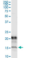 5 - KCNE1 Antibody (monoclonal) (M13) AT2593a