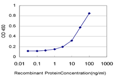 10 - LASS4 Antibody (monoclonal) (M01) AT2675a