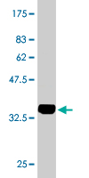 1 - LASS4 Antibody (monoclonal) (M01) AT2675a