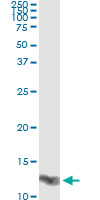 5 - LGALS1 Antibody (monoclonal) (M01) AT2700a