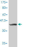 1 - MASA Antibody (monoclonal) (M01) AT2806a