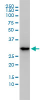 1 - MASA Antibody (monoclonal) (M01) AT2806a