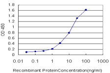 10 - MCCC1 Antibody (monoclonal) (M01) AT2816a