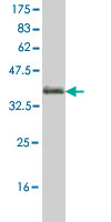 1 - MCCC1 Antibody (monoclonal) (M01) AT2816a