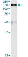 5 - MCM2 Antibody (monoclonal) (M01) AT2818a