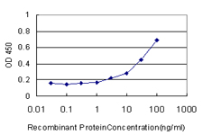 10 - ME1 Antibody (monoclonal) (M02) AT2829a
