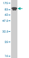 1 - ME1 Antibody (monoclonal) (M02) AT2829a