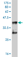 1 - MEF2D Antibody (monoclonal) (M04) AT2839a