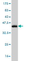 1 - MGAT4A Antibody (monoclonal) (M02) AT2856a