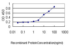 10 - MGC3207 Antibody (monoclonal) (M01) AT2864a