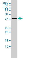 1 - MGC3207 Antibody (monoclonal) (M01) AT2864a
