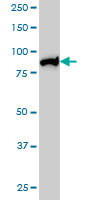1 - MLH1 Antibody (monoclonal) (M02) AT2879a