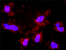 1 - MLH1 Antibody (monoclonal) (M02) AT2879a