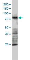 1 - MRE11A Antibody (monoclonal) (M01) AT2901a
