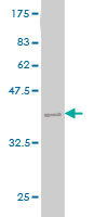 1 - MTHFS Antibody (monoclonal) (M01) AT2931a