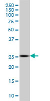 1 - MTHFS Antibody (monoclonal) (M01) AT2931a