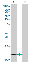 1 - MYCBP Antibody (monoclonal) (M08) AT2946a