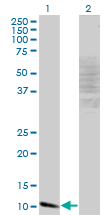 1 - MYCBP Antibody (monoclonal) (M13) AT2947a