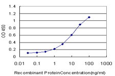 10 - NDUFB11 Antibody (monoclonal) (M08) AT3001a