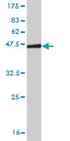 1 - NDUFB11 Antibody (monoclonal) (M08) AT3001a