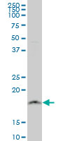 1 - NDUFB11 Antibody (monoclonal) (M08) AT3001a