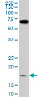 1 - NDUFB11 Antibody (monoclonal) (M08) AT3001a