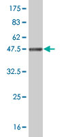 1 - NDUFB11 Antibody (monoclonal) (M12) AT3002a