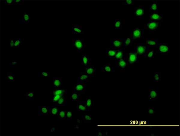 3 - NKX3-1 Antibody (monoclonal) (M02) AT3058a