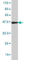 1 - NKX3-1 Antibody (monoclonal) (M02) AT3058a