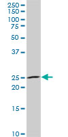 1 - NKX3-1 Antibody (monoclonal) (M02) AT3058a