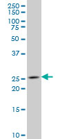 1 - NKX3-1 Antibody (monoclonal) (M02) AT3058a