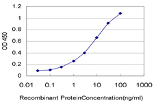 10 - NKX3-1 Antibody (monoclonal) (M02) AT3058a