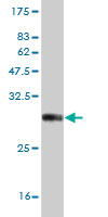 1 - NKX3-1 Antibody (monoclonal) (M03) AT3059a