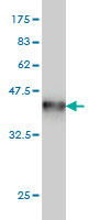 1 - NME1 Antibody (monoclonal) (M02) AT3065a