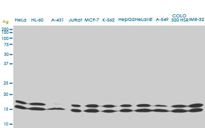 1 - NME1 Antibody (monoclonal) (M02) AT3065a