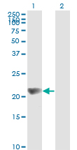 1 - NME1 Antibody (monoclonal) (M02) AT3065a