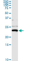5 - NME1 Antibody (monoclonal) (M02) AT3065a
