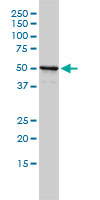 1 - NPEPL1 Antibody (monoclonal) (M01) AT3084a
