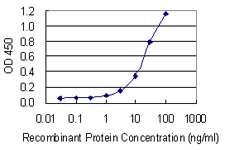 10 - NPM1 Antibody (monoclonal) (M01) AT3085a