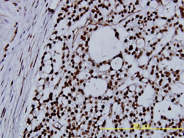 2 - NPM1 Antibody (monoclonal) (M01) AT3085a