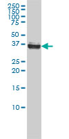 1 - NPM1 Antibody (monoclonal) (M01) AT3085a