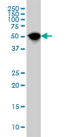 1 - NR1H4 Antibody (monoclonal) (M01) AT3098a