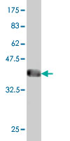1 - NUDT10 Antibody (monoclonal) (M01) AT3127a