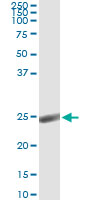5 - ORM1 Antibody (monoclonal) (M01) AT3156a