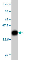 1 - PARK2 Antibody (monoclonal) (M01) AT3182a