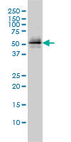 1 - PARK2 Antibody (monoclonal) (M01) AT3182a