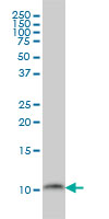 1 - PCBD1 Antibody (monoclonal) (M01) AT3207a