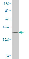 1 - PCDH1 Antibody (monoclonal) (M05) AT3211a