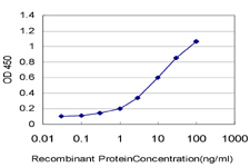 10 - PCDH11Y Antibody (monoclonal) (M02) AT3213a